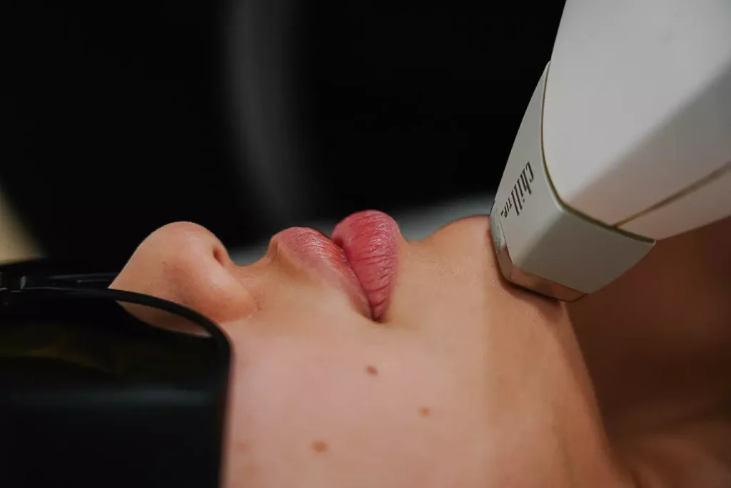 Three Laser Hair-Removal Sessions at SpaDerma Wicker Park(Up to 83% Off) (Copy)